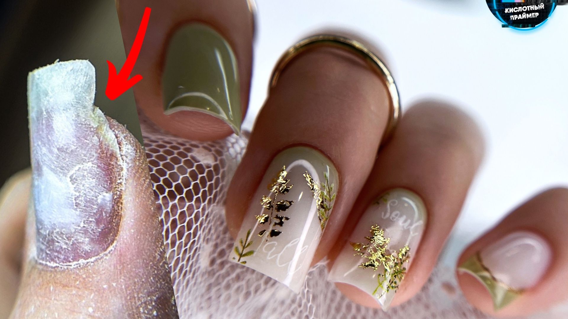 ВОТ К ЧЕМУ ПРИВОДЯТ ОТСЛОЙКИ! УКРЕПЛЕНИЕ ГЕЛЕМ! Восстановление архитектуры без полигеля смотреть онлайн