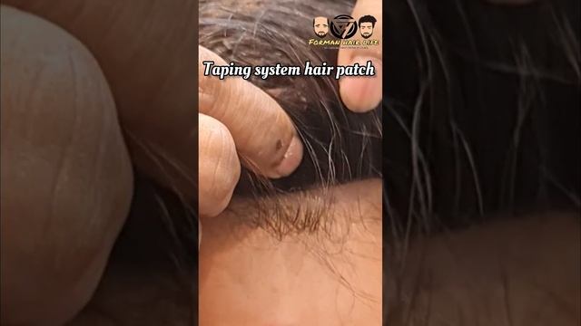best hair patch in kolkata ? best hair cut ? hair patch services in kolkata #shorts смотреть онлайн