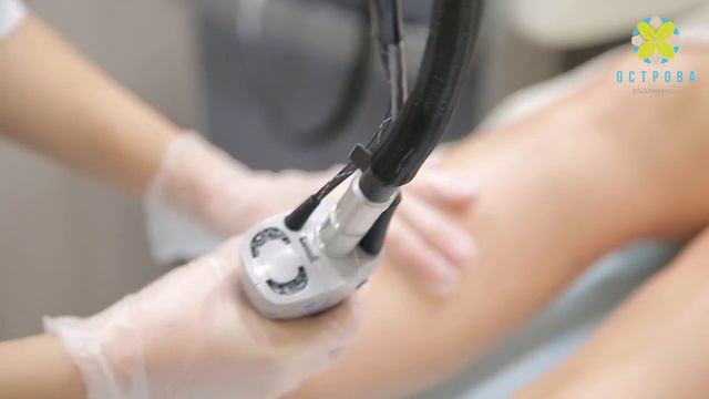 Острова Лазерная эпиляция смотреть онлайн