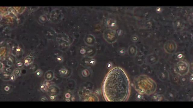 Опалины (Opalinea) и гексамидиды (рода Hexamita или Spironucleus) смотреть онлайн