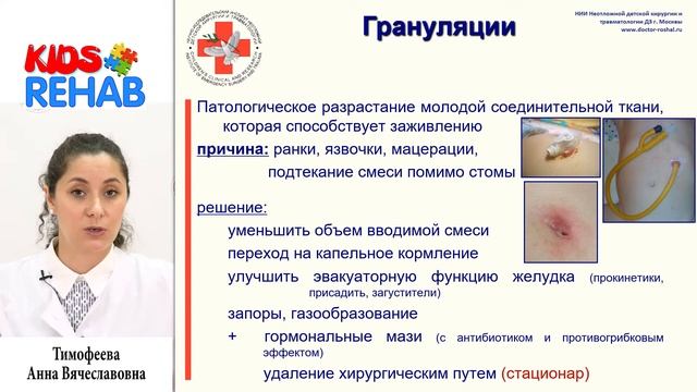 Осложнения у детей с гастростомами смотреть онлайн