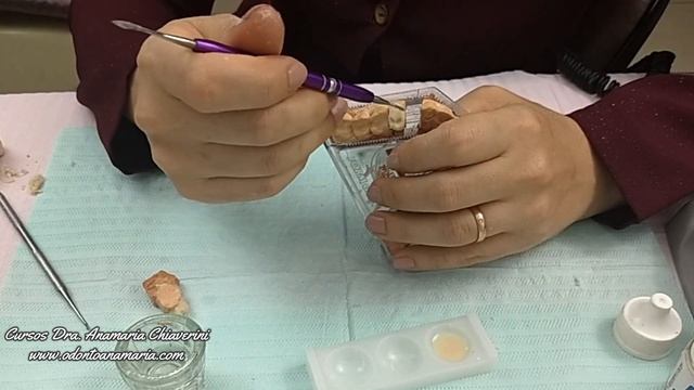 Aula 5 - Técnica Infalível de Como fazer uma Coroa Provisória de Resina Acrílica no Consultório #34 смотреть онлайн