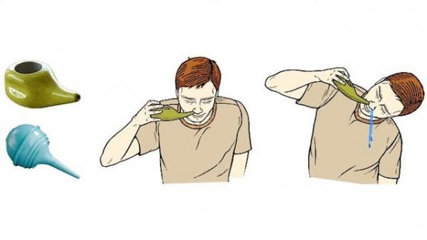 Как правильно промывать нос в домашних условиях: советы