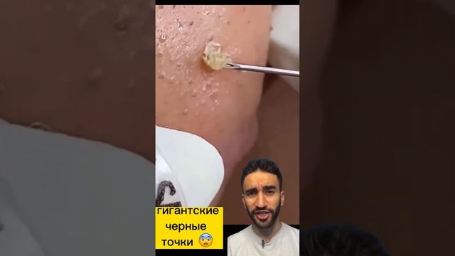 это что гигантские черные точки? смотреть онлайн