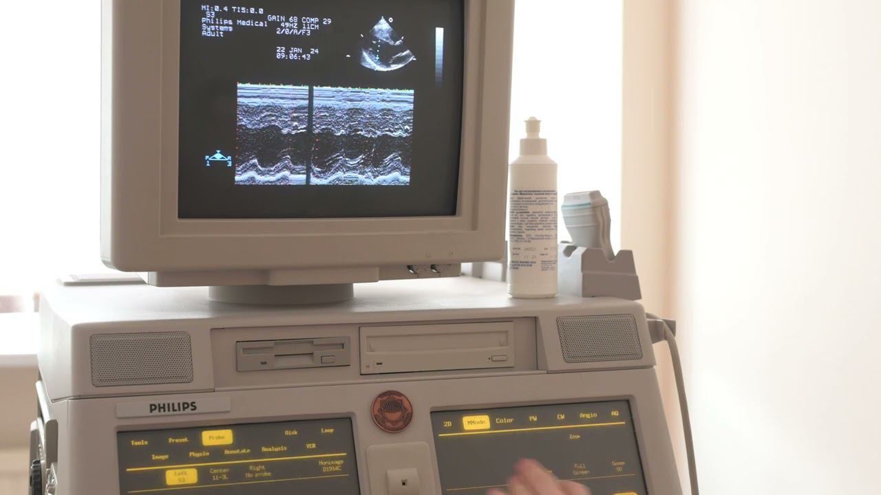 Эхокардиография. Занятие 10: Измерения (на настоящем УЗ аппарате) смотреть онлайн