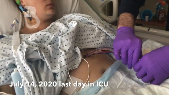 Wyatt's Open Heart Surgery смотреть онлайн