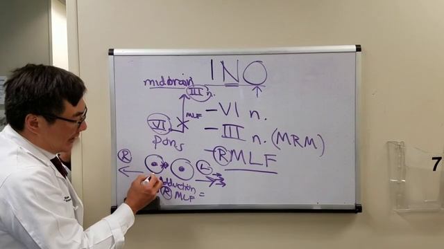 Internuclear Ophthalmoplegia (INO) смотреть онлайн