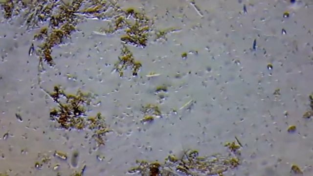 Много бактерий в воде из под роз под микроскопом смотреть онлайн