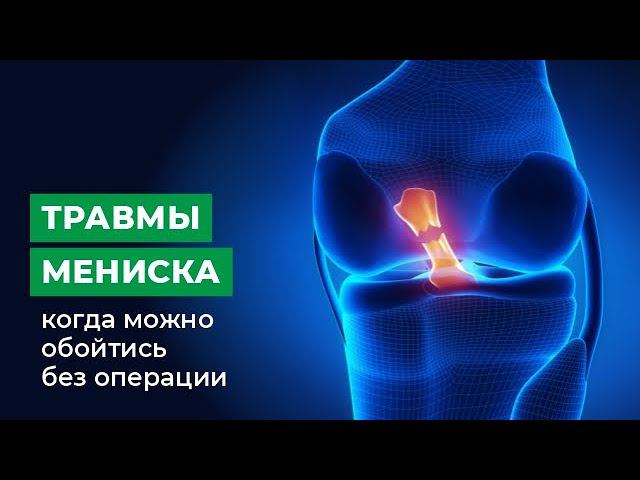Травмы мениска - когда можно обойтись без операции