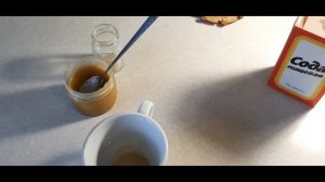 Гайморит лечение в домашних условиях / два метода / работает 100%