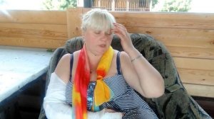 Допрыгалась! перелом локтевого сустава, головки лучевой кости.  Ч1.