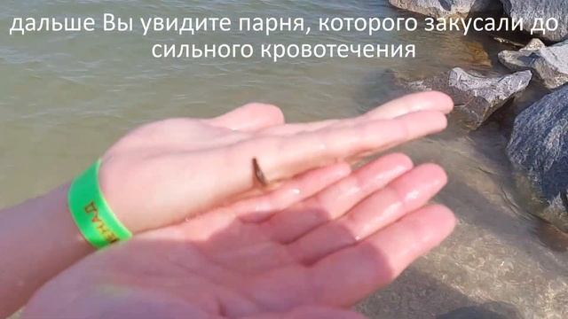 Морские блохи искусали парня до кровотечения смотреть онлайн