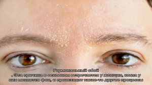 Шелушится кожа под бровями: причины. Что делать, если шелушится кожа у бровей: лечение