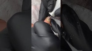 Вскрытие панариция. Практическая часть. #панариций #подология #russia #balakovo #помощь