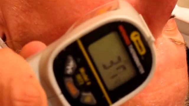 Pelleve by Dr. Michael Stampar | 941-205-3030 |Pelleve Skin Tightening Treatment смотреть онлайн