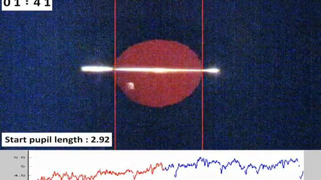 FIM pupil dilation test смотреть онлайн