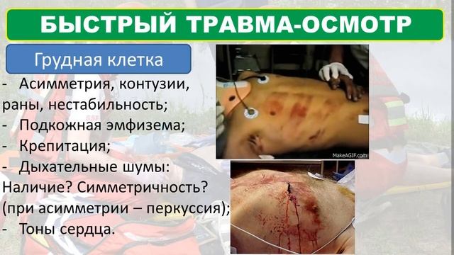Травма на догоспитальном этапе. часть 2. Травма-осмотр. смотреть онлайн
