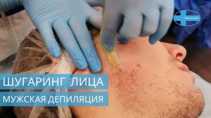 Мужская  сахарная депиляция Зона лица. Обучение с сертификатом. Видео курс Мужской шугаринг лица