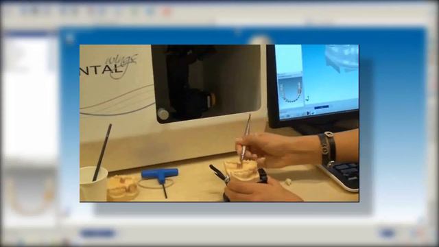 Digital Dental Lab Part IV - CAD Design of an Implant Abutment смотреть онлайн