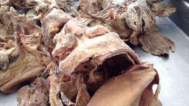 подключичная и подмышечная 2 смотреть онлайн