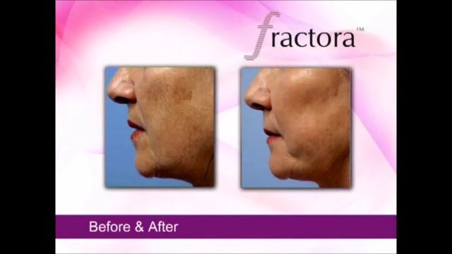 Фрактора смотреть онлайн