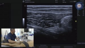 Седалищный нерв.