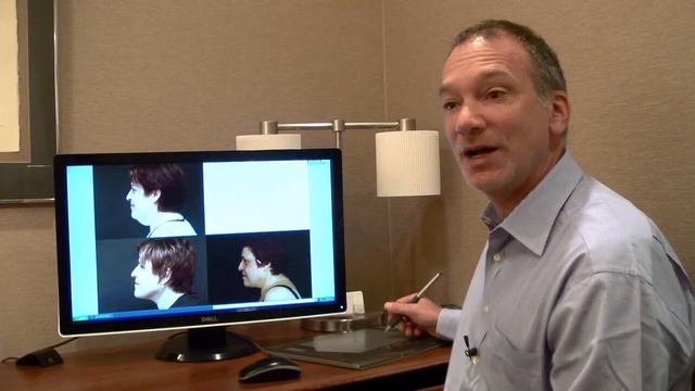 How Long Facelifts Last - New Jersey - Dr. Mark Glasgold смотреть онлайн