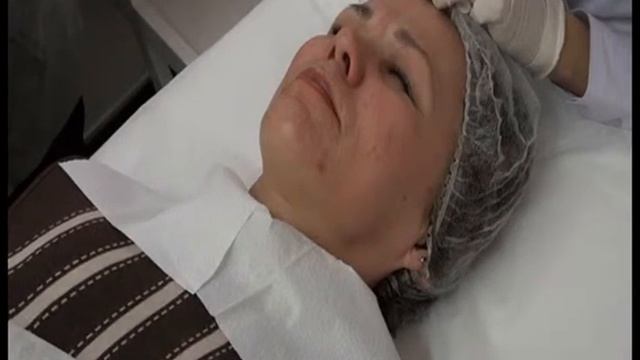 Биоревитализация - Принцесс Filler можно вводить точечно! смотреть онлайн