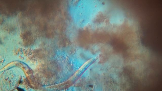 слизь на фильтре в системе обратного осмоса через шесть месяцев смотреть онлайн