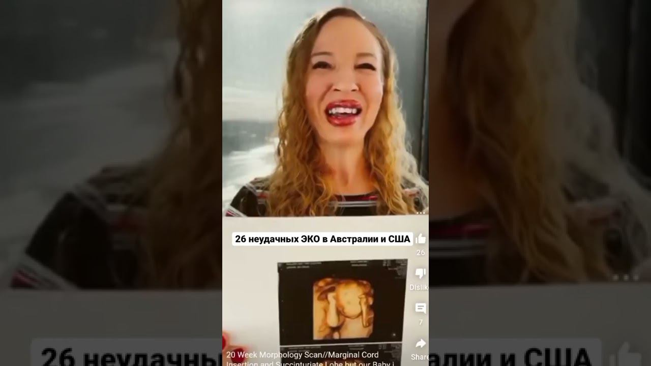 Реально ли родить после 26 неудачных ЭКО? #shorts