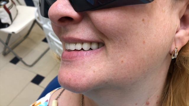 Два полных съемных протеза смотреть онлайн