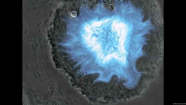 Tal Danino: We can use bacteria to detect cancer (and maybe treat it) смотреть онлайн