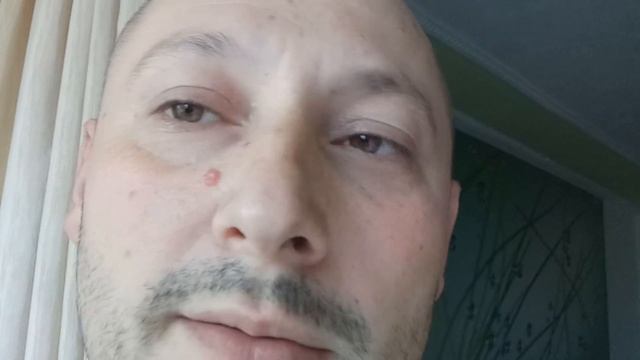 Очиститель инжектора WINDIGO Injector Cleaner и капитальный ремонт Volkswagen Tiguan смотреть онлайн