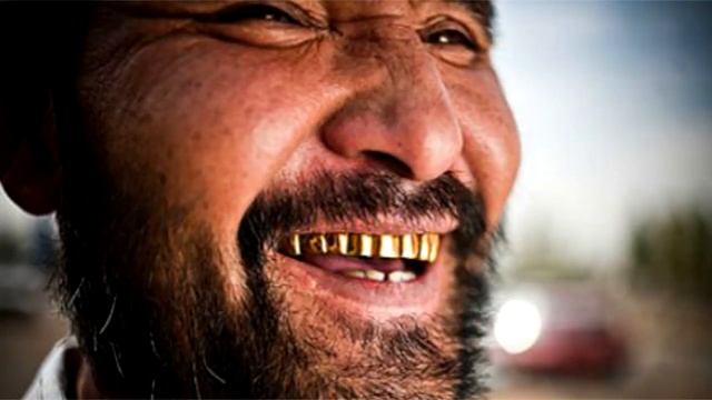 Модный бум: Кто из звезд носит золотые зубы и почему это запретили некоторым чиновникам смотреть онлайн
