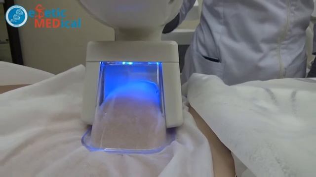 Криолиполиз коррекция фигуры в Одессе в Estetic Medical смотреть онлайн