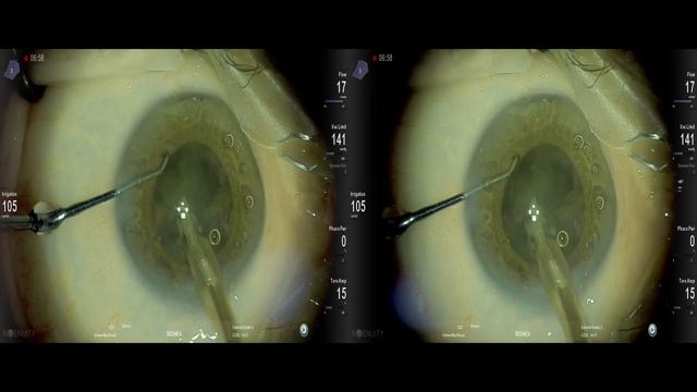 Lux good "stuck haptic" Leica Proveo Lukan Mishev live stream смотреть онлайн