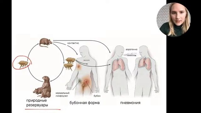 Всё о чумной палочке Y. Рestis | Частная микробиология смотреть онлайн