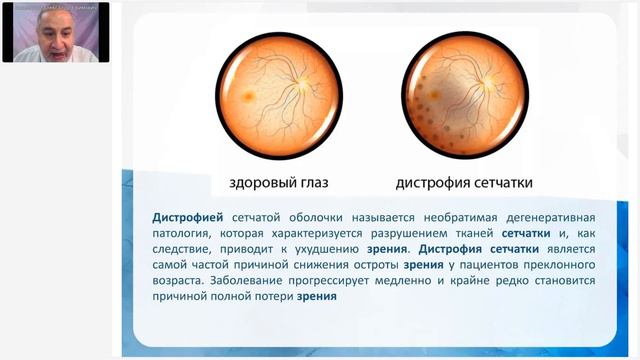 Аксельрод А.Е.«МАСТЕР-КЛАСС «ВОСЕМЬ СЕКРЕТОВ ВИД (ИМПУЛЬСНО-ДИНАМИЧЕСКОГО ВОЗДЕЙСТВИЯ)».Ч.2» 6.12.2 смотреть онлайн