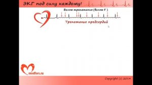 Урок 5  Видеокурс ЭКГ под силу каждому