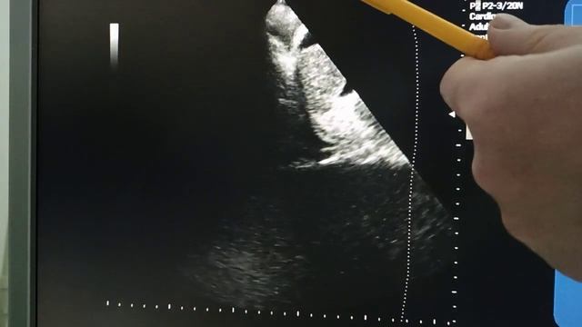 Пример исследования по протоколу FAST смотреть онлайн