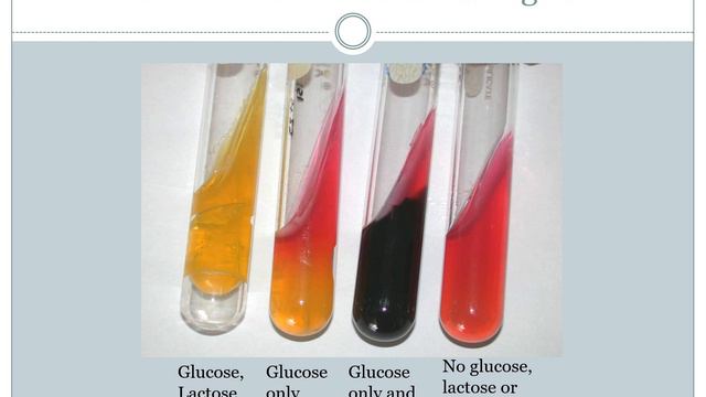 Unit 7, Enteric metabolism tests narrated смотреть онлайн