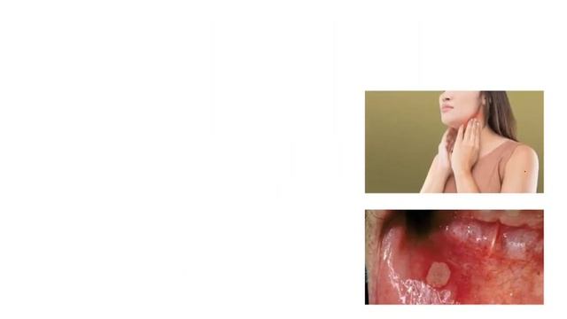 What are the earliest symptoms of HIV? смотреть онлайн