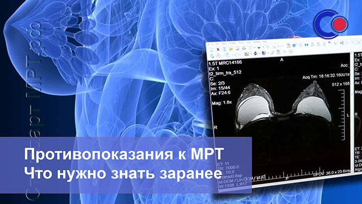 Противопоказания к МРТ. Что нужно знать заранее - 7 полезных фактов