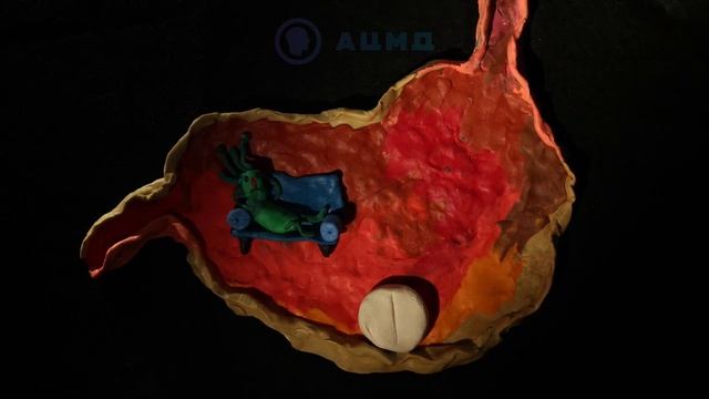 О хеликобактер пилори за 1 минуту. Лечение и симптомы Helicobacter Pylori в желудке