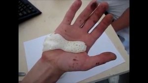 Жидкий бинт