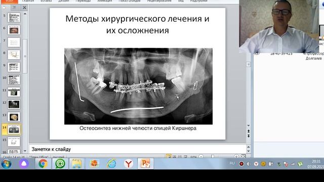 Ложные суставы. Ортопедическое лечение смотреть онлайн