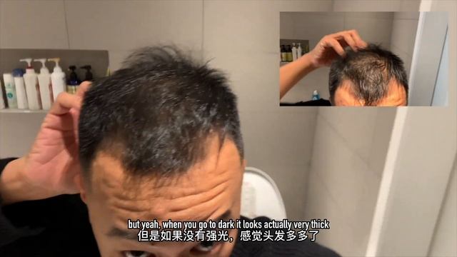 MY ROGAINE REVIEW & UPDATE I Most SERIOUS Shed & Hairloss After 2.5 YEARS OF USE смотреть онлайн