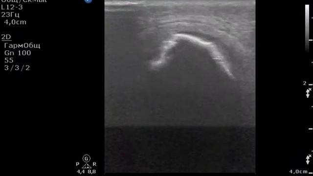 Совсем не Шляттер. смотреть онлайн