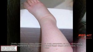 Болят почки симптомы заболевания почек