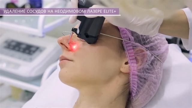 УДАЛЕНИЕ СОСУДОВ НА НЕОДИМОВОМ ЛАЗЕРЕ ELITE+ смотреть онлайн